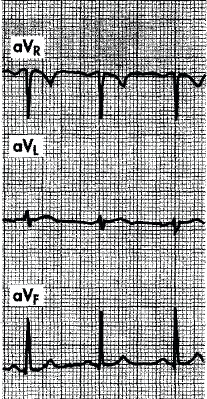 Question 18 diagram