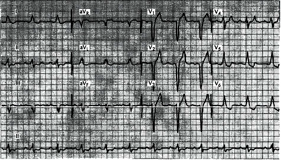 Question 3 diagram