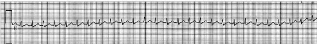 Question 23 diagram