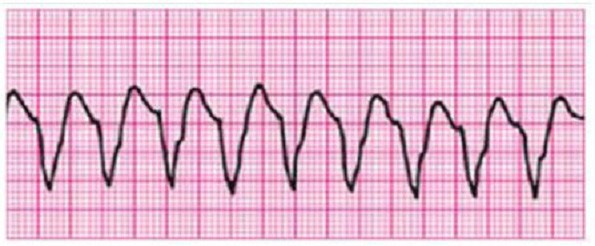 Question 2 diagram