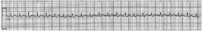 Question 40 diagram