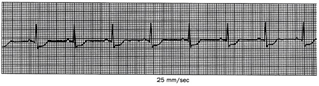 Question 9 diagram