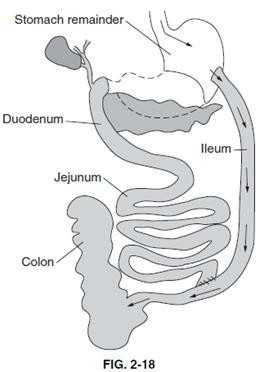 Question 97 diagram